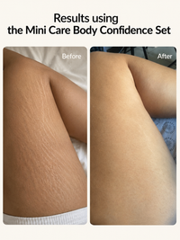 Mini Care Body Confidence Bundle