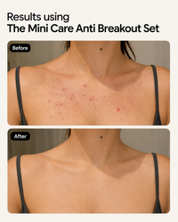 Mini Care Radiant Lush