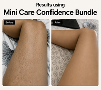 Mini Care Body Confidence Bundle