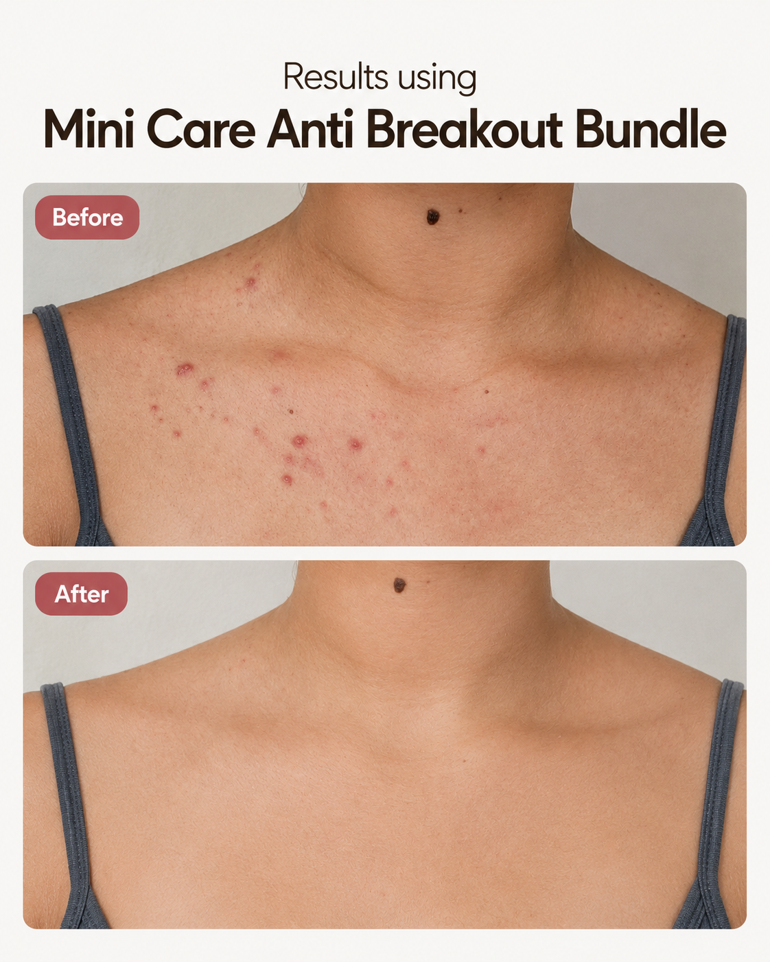 Mini Care Bye, breakouts